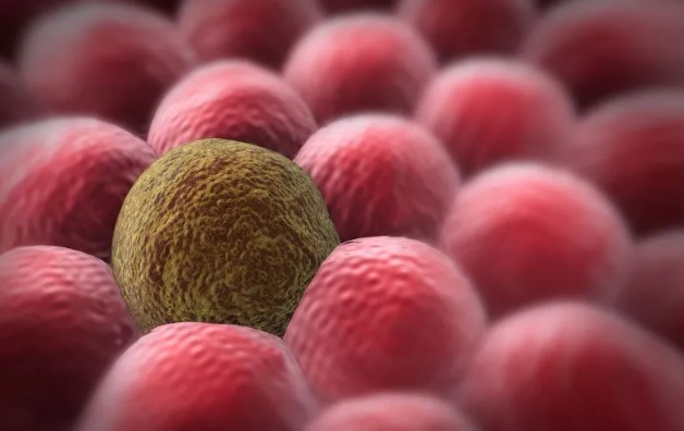 得了癌症醫保不夠用怎麼辦