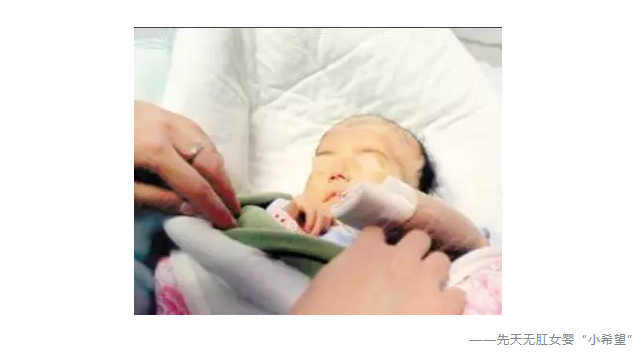 缺陷嬰兒適合什麼保險？